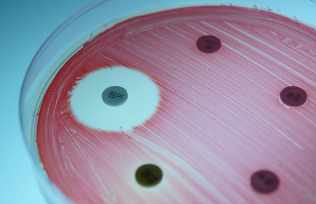 How to Measure the Zone of Inhibition: Kirby-Bauer Test